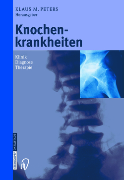 Knochenkrankheiten von Eysel,  P., Peters,  Klaus M.