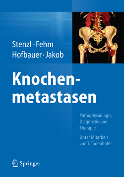 Knochenmetastasen von Fehm,  Tanja, Hofbauer,  Lorenz C., Jakob,  Franz, Stenzl,  Arnulf