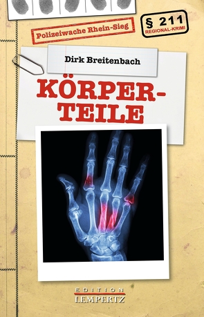 Körperteile von Breitenbach,  Dirk