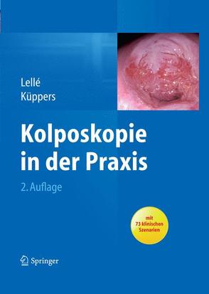 Kolposkopie in der Praxis von Küppers,  Volkmar, Lellé,  Ralph J.