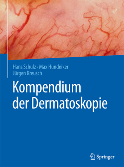 Kompendium der Dermatoskopie von Hundeiker,  Max, Kreusch,  Jürgen, Schulz,  Hans