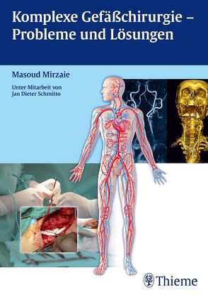 Komplexe Gefäßchirurgie – Probleme und Lösungen von Mirzaie,  Masoud, Schmitto,  Jan Dieter