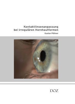 Kontaktlinsenanpassung bei irregulären Hornhautformen von Pöltner,  Gustav