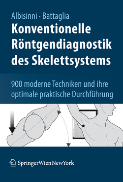 Konventionelle Röntgendiagnostik des Skelettsystems von Albisinni,  Ugo, Battaglia,  Milva