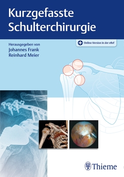 Kurzgefasste Schulterchirurgie von Frank,  Johannes, Meier,  Reinhard