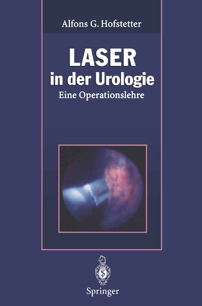 Laser in der Urologie von Baumgartner,  R., Berlien,  H.-P., Ehsan,  A., Frank,  F., Friesen,  A., Fuchs,  B., Gorisch,  W., Hofstetter,  Alfons G., Klammert,  R., Kriegmair,  M., Lubos,  W., Müller,  G., Mutschter,  R., Rothenberger,  K.-H., Schmeller,  N., Schneede,  P., Waidelich,  W., Wondrazek,  F.