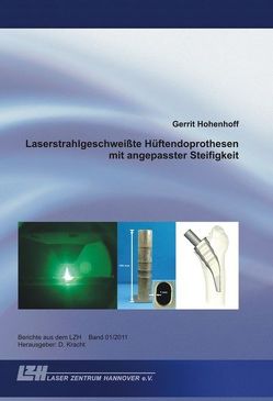 Laserstrahlgeschweißte Hüftendoprothesen mit angepasster Steifigkeit von Hohenhoff,  Gerrit, Kracht,  Dietmar