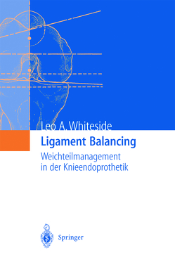 Ligament Balancing von Whiteside,  Leo A.