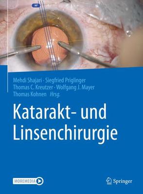 Katarakt- und Linsenchirurgie von Kohnen,  Thomas, Kreutzer,  Thomas C., Mayer,  Wolfgang J., Priglinger,  Siegfried, Shajari,  Mehdi