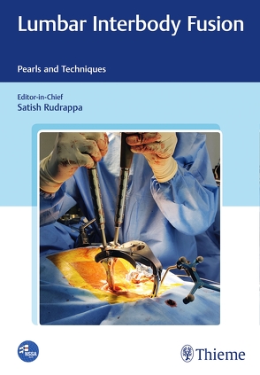 Lumbar Interbody Fusion von Rudrappa,  Satish