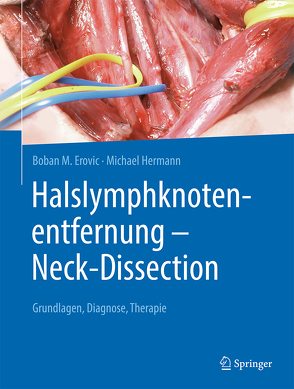Halslymphknotenentfernung – Neck-Dissection von Erovic,  Boban M., Hermann,  Michael