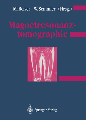 Magnetresonanztomographie von Reiser,  Maximilian, Semmler,  Wolfhard