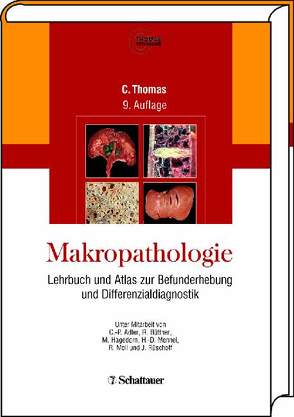 Makropathologie von Thomas,  Carlos