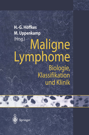 Maligne Lymphome von Höffkes,  Heinz-Gert, Uppenkamp,  Michael