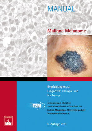 Maligne Melanome von Berking,  C., Tumorzentrum München
