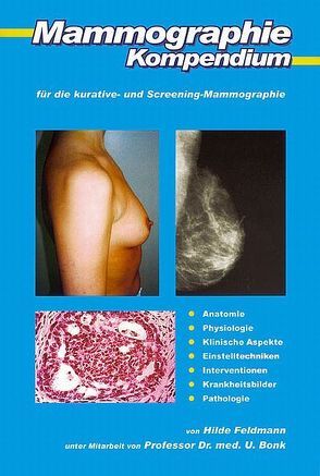 Mammographie-Kompendium für die kurative- und Screening-Mammographie von Bonk,  Ulrich, Feldmann,  Hilde