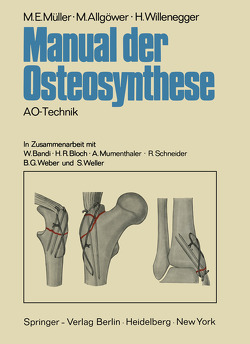 Manual der Osteosynthese von Allgöwer,  M., Bandi,  W., Bloch,  H. R., Müller,  M.E., Mumenthaler,  A., Scheider,  R., Weber,  B. G., Willenegger,  H.