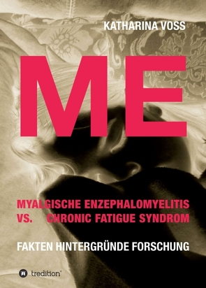 ME – Myalgische Enzephalomyelitis vs. Chronic Fatigue Syndrom von Voß,  Katharina