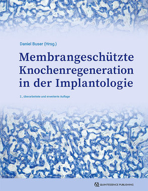 Membrangeschützte Knochenregeneration in der Implantologie von Buser,  Daniel