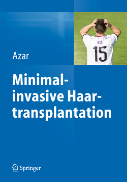 Minimalinvasive Haartransplantation von Azar,  Reza P.