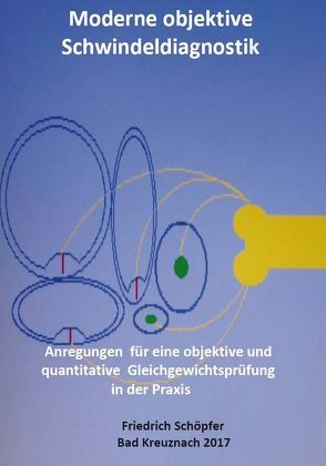 Moderne objektive Schwindeldiagnostik von Schöpfer,  Friedrich