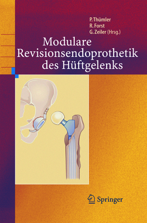 Modulare Revisionsendoprothetik des Hüftgelenks von Forst,  Raimund, Thümler,  Peter, Zeiler,  Günther