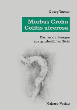 Morbus Crohn – Colitis Ulcerosa von Tecker,  Georg