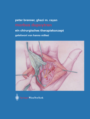 Morbus Dupuytren von Brenner,  Peter, Gratzer,  J., Millesi,  H., Rayan,  Ghazi M., Schimek,  H.