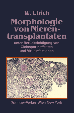 Morphologie von Nierentransplantaten von Ulrich,  Walter