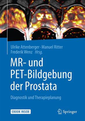 MR- und PET-Bildgebung der Prostata von Attenberger,  Ulrike, Ritter,  Manuel, Wenz,  Frederik