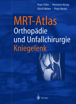 MRT-Atlas Orthopädie und Unfallchirurgie von Hamm,  B, Hertel,  Peter, König,  Hermann, Teller,  Peter, Weber,  Ulrich