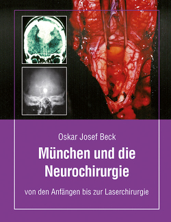 München und die Neurochirurige von Beck,  Oskar