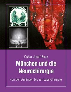 München und die Neurochirurige von Beck,  Oskar