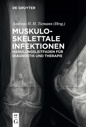 Muskuloskelettale Infektionen von Braunschweig,  Rainer, Frommelt,  Lars, Tiemann,  Andreas Heinrich