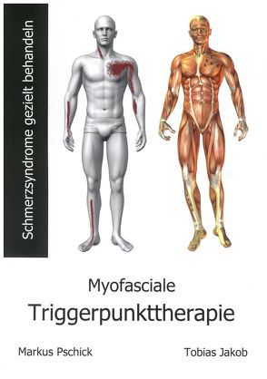 Myofasciale Triggerpunkttherapie von Jakob,  Tobias, Pschick,  Markus
