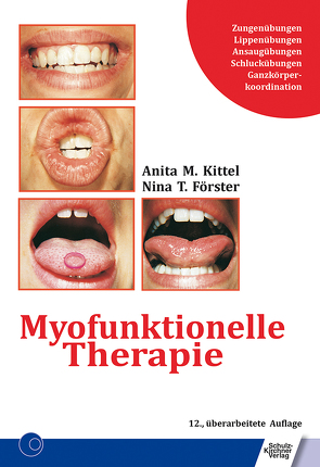 Myofunktionelle Therapie von Förster,  Nina T., Kittel,  Anita