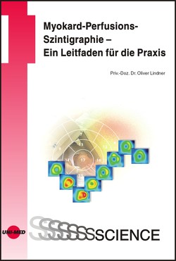 Myokard-Perfusions-Szintigraphie – Ein Leitfaden für die Praxis von Lindner,  Oliver