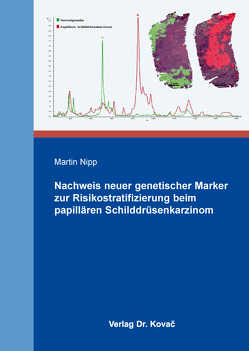 Nachweis neuer genetischer Marker zur Risikostratifizierung beim papillären Schilddrüsenkarzinom von Nipp,  Martin