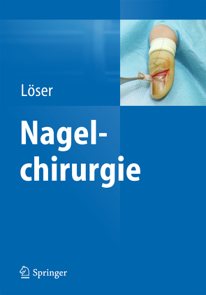 Nagelchirurgie von Löser,  Christoph