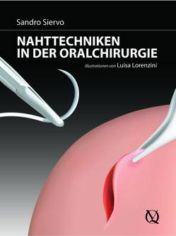 Nahttechniken in der oralen Chirurgie von Lorenzini,  Luisa, Siervo,  Sandro