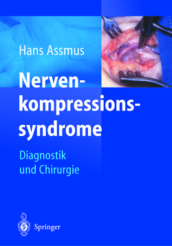 Nerven-kompressions-syndrome von Antoniadis,  G.