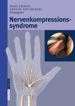 Nervenkompressionssyndrome von Antoniadis,  Gregor, Assmus,  Hans