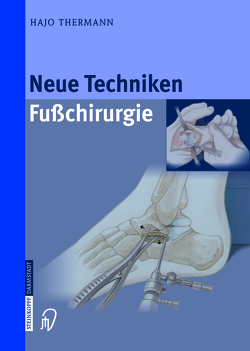 Neue Techniken Fusschirurgie von Thermann,  Hajo
