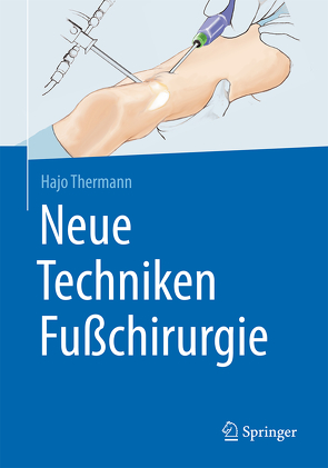 Neue Techniken Fußchirurgie von Thermann,  Hajo