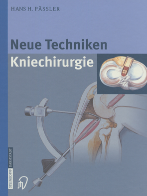 Neue Techniken Kniechirurgie von Pässler,  H.H., Thermann,  H.