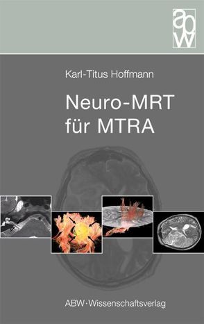 Neuro-MRT für MTRA von Hoffmann,  Karl-Titus