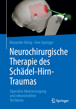 Neurochirurgische Therapie des Schädel-Hirn-Traumas von Koenig,  Alexander, Spetzger,  Uwe