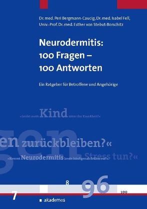 Neurodermitis: 100 Fragen – 100 Antworten von Caucig,  Peri, Fell,  Isabel, Stebut,  Esther von