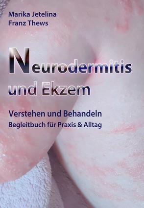 Neurodermitis und Ekzem von Jetelina,  Marika, Thews,  Franz