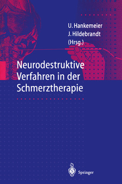 Neurodestruktive Verfahren in der Schmerztherapie von Hankemeier,  U. B., Hildebrandt,  J.